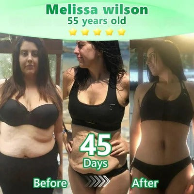 Melissa Wilson before and after results
