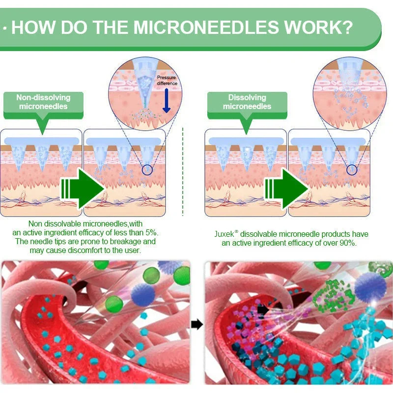 How dissolving microneedles work